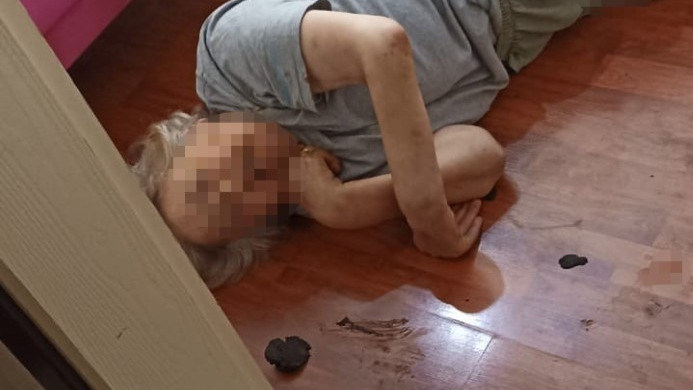 Yatalak annesini döverek komalık etmişti, gözaltına alındı