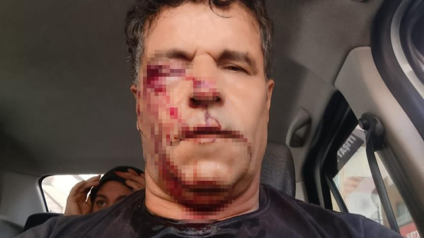 Kafası taşla ezilmek istenen baygın kocasını  taş atarak kurtardı