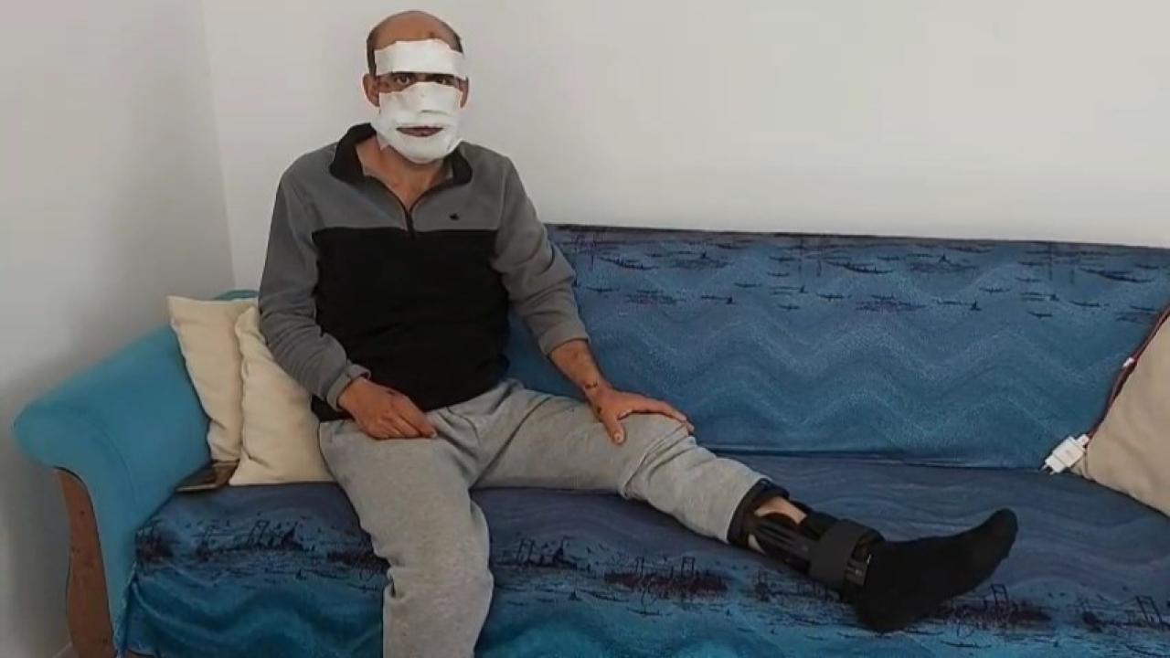 Eniştesine araçla çarpıp kaçtı