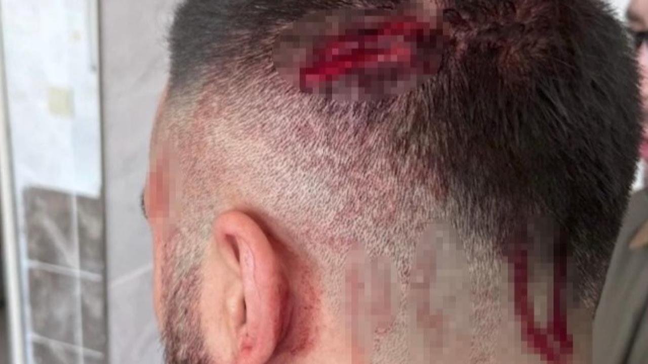 Öğretmen, veli tarafından sopayla darbedildi