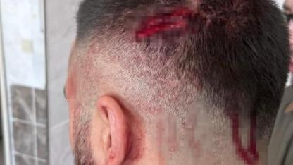 Öğretmen, veli tarafından sopayla darbedildi
