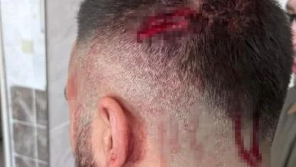 Öğretmen, veli tarafından sopayla darbedildi