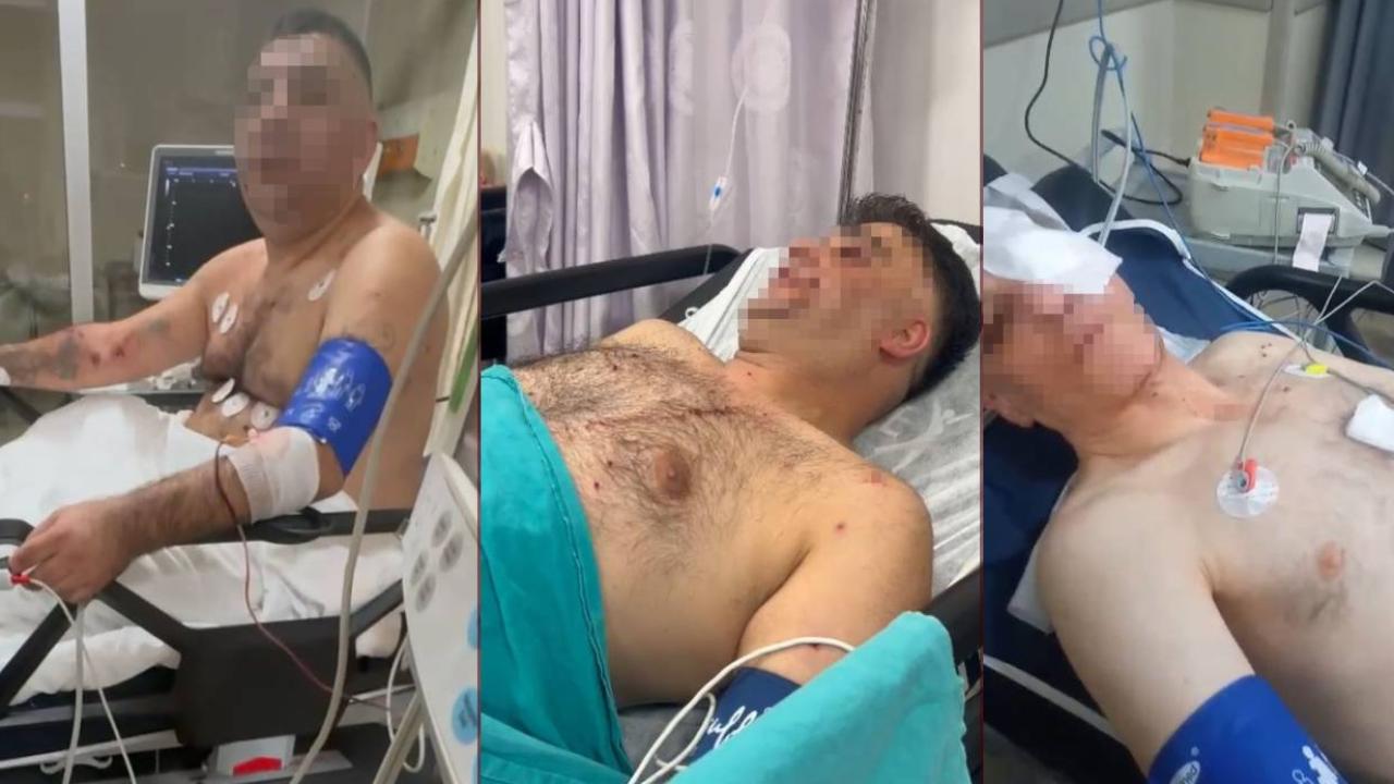 Pompalı tüfekle çevreye ateş eden şahıs, 1’i polis 4 kişiyi yaraladı