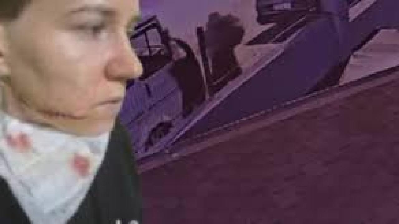 Saldırıya uğrayan Ukraynalı kadının kimliği belli oldu, yüzündeki derin çizik dikkat çekti