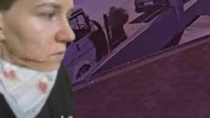 Saldırıya uğrayan Ukraynalı kadının kimliği belli oldu, yüzündeki derin çizik dikkat çekti