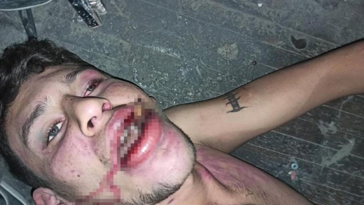 Hamam böceği yedirilen genç dosyasında karar: Yağmadan beraat, hürriyeti tehditten 6 yıl 12 ay ceza