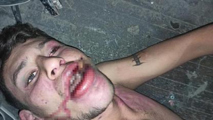 Hamam böceği yedirilen genç dosyasında karar: Yağmadan beraat, hürriyeti tehditten 6 yıl 12 ay ceza