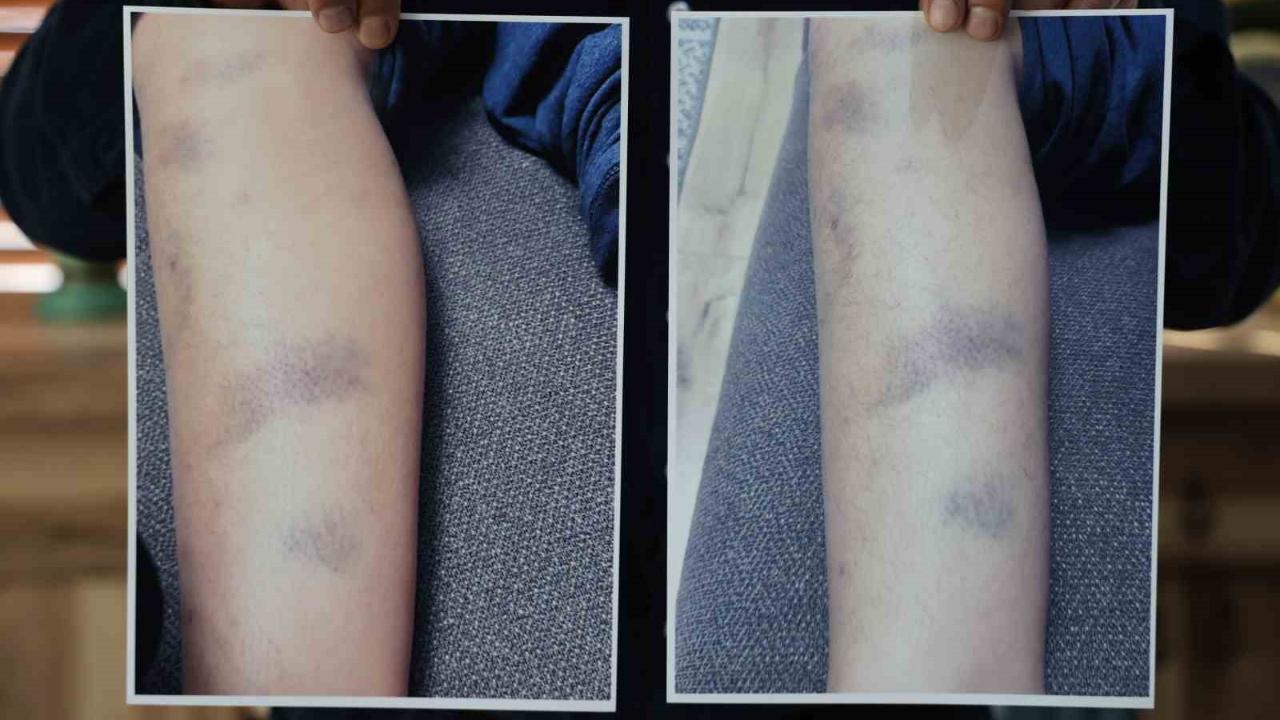 Özel okulda 8 yaşındaki çocuğun darbedildiği iddiası