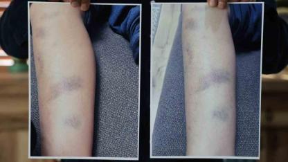 Özel okulda 8 yaşındaki çocuğun darbedildiği iddiası