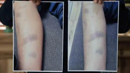 Özel okulda 8 yaşındaki çocuğun darbedildiği iddiası