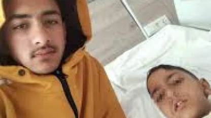 Ankara’da sokak köpeğinin saldırısına uğrayan çocuk yaralandı