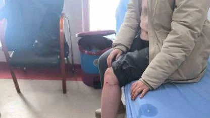 Kayseri’de sokak köpeğinin saldırısına uğrayan çocuk yaralandı
