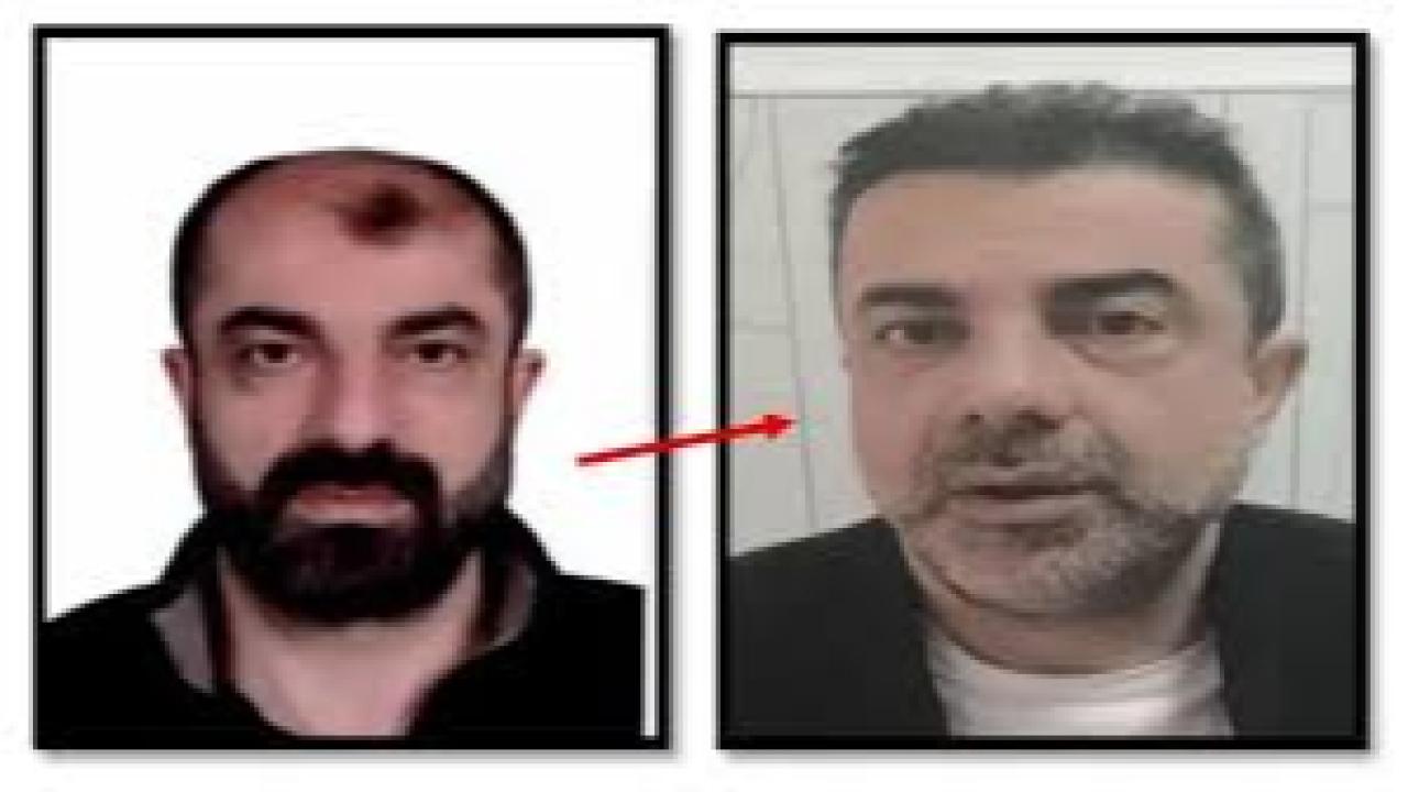 Ameliyat ile yüzünü değiştiren firari cinayet zanlısı, 7 yıl sonra yakalandı