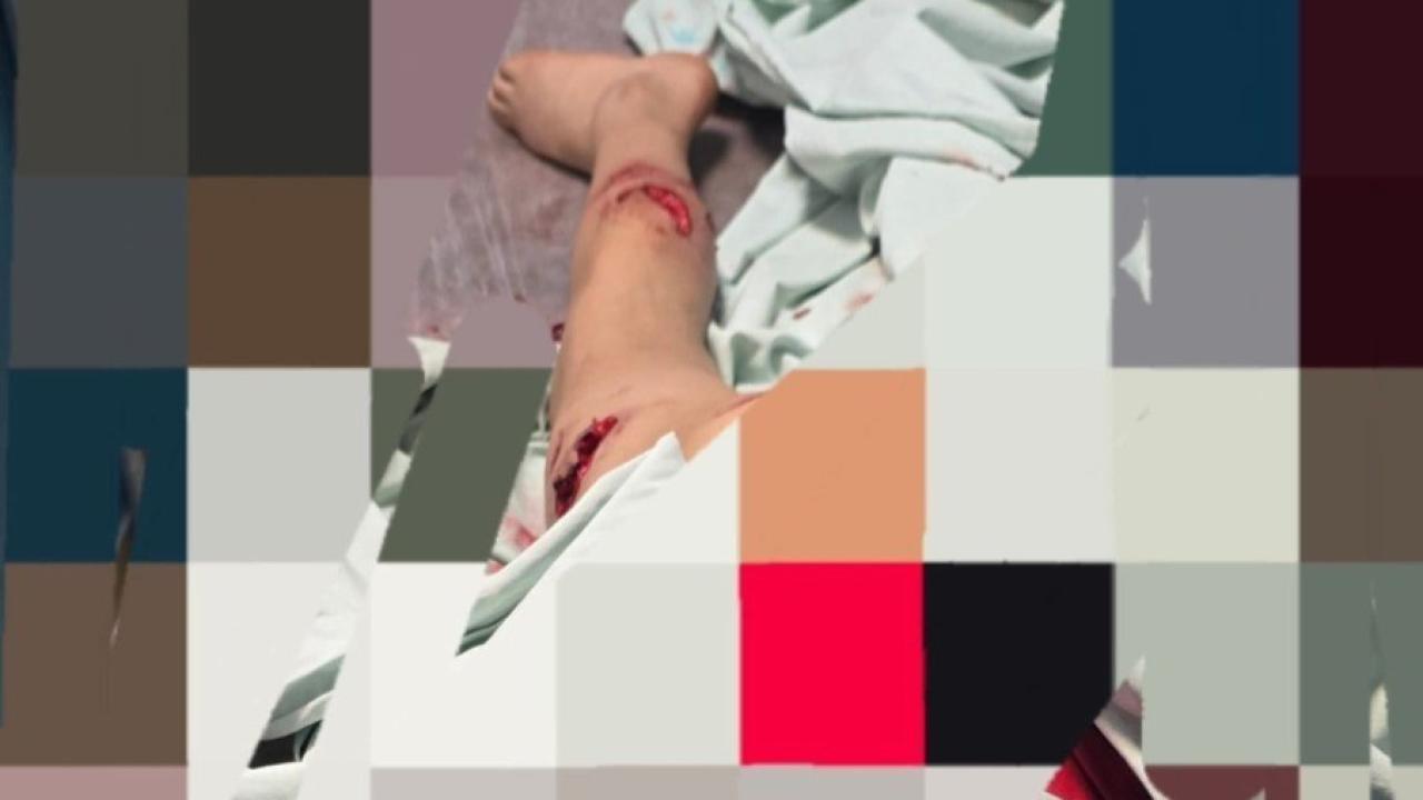 11 yaşındaki çocuk parçalamaktan son anda kurtuldu